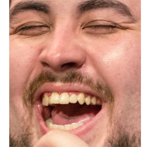 Стикер BTTV & FFZ HD